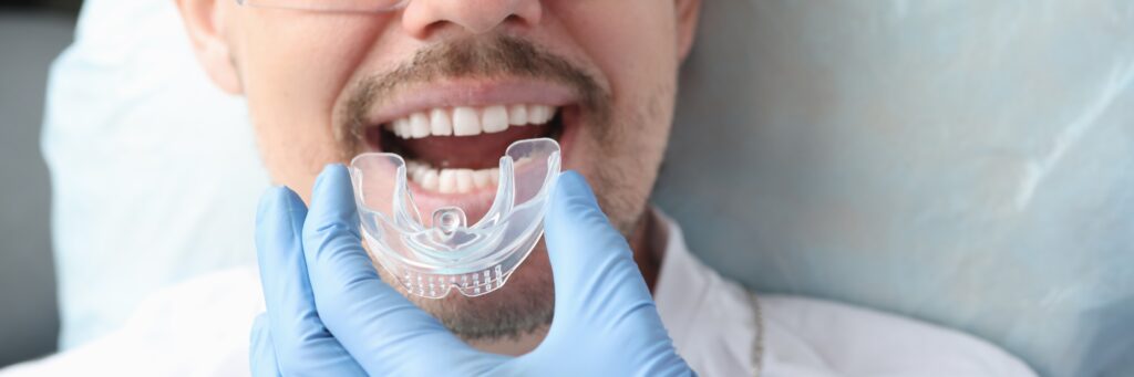 Mouthguards greenwood
