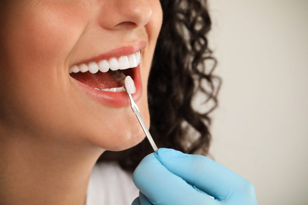 dental crowns greenwood